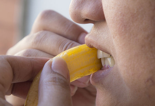 Dişlerinizi beyazlatmanın 5 yolu