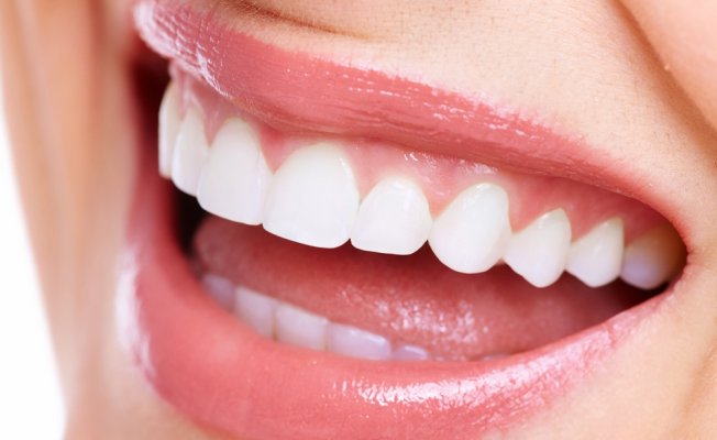Diş taşı ağız sağlığını olumsuz etkiliyor