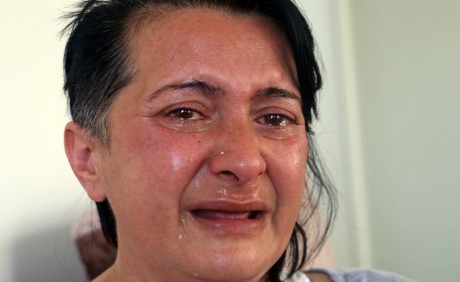 Beyaz Diş İsterken Dişlerin'den Oldu