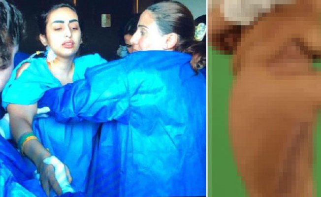 Çene Ameliyatı İçin Gitti Bakın Ne Oldu Çene Ameliyatı İçin Gitti Bakın Ne Oldu