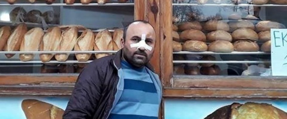 Ucuz Ekmek Sattığı İçin Dayak Yedi