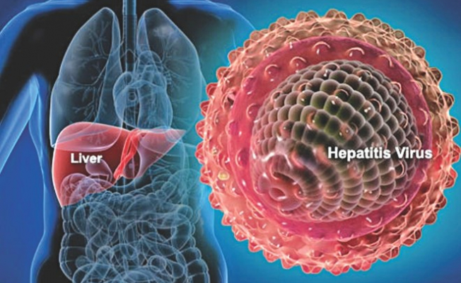 Hepatit A hastalığı nedir? Belirtileri Nelerdir?