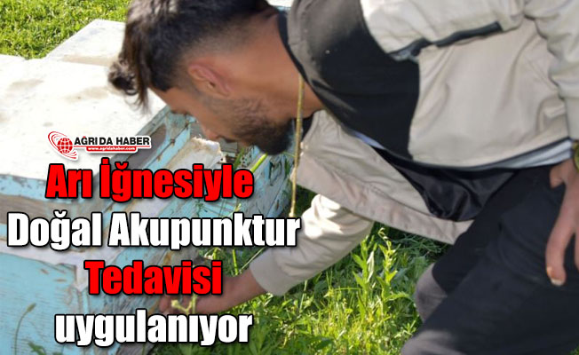 Ağrı'da Arı İğnesiyle Akupunktur Tedavisi Uygulanıyor!