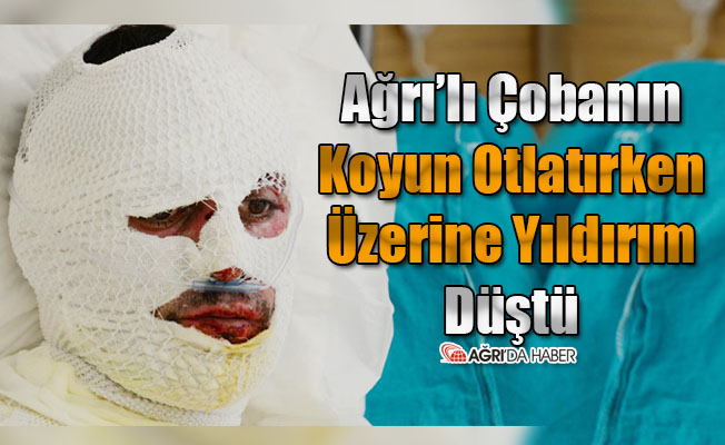 Ağrılı Çoban'ın Üzerine Yıldırım Düştü