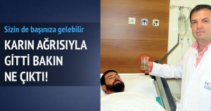 Safra kesesinden 512 taş çıktı Safra kesesinden 512 taş çıktı