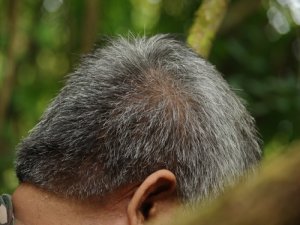 Sağlıklı İnsanlarda Olması Gereken Saç Dökülmesi Sayısı Kaçtır?