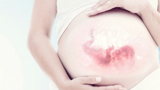 Bebekte gelişme geriliği nedir? Bebek Gelişimi ?