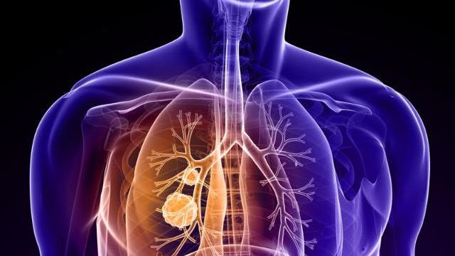 Elektronik sigaralar da masum değil! Kanser, kalp ve akciğer hastalıklarına neden oluyor