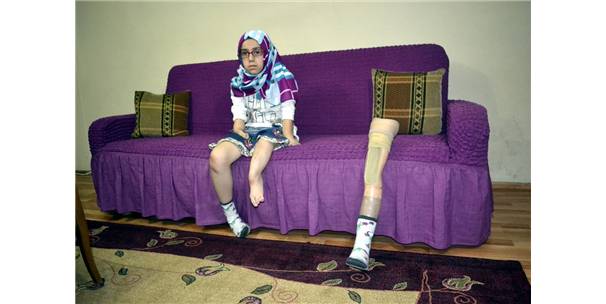 Sağlık Bakanlığı protezle yürüyebilen Kader'e Sahip Çıktı