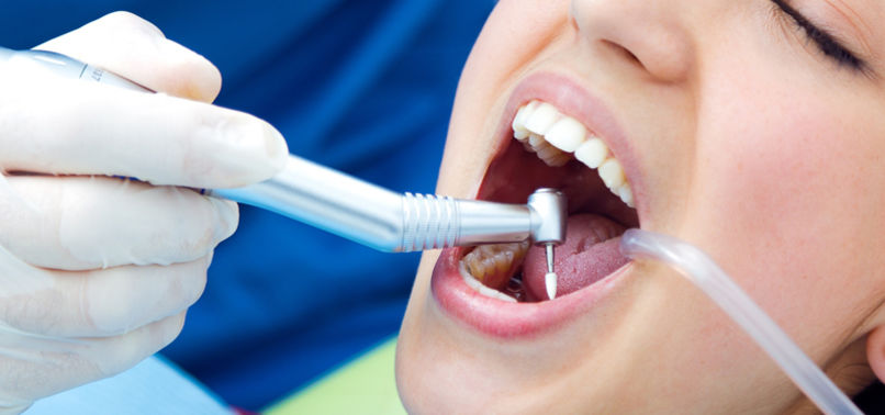 Diş dolgusu yapılmayacak artık ! etkili ve doğal bir tedavi ile halledilecek ?
