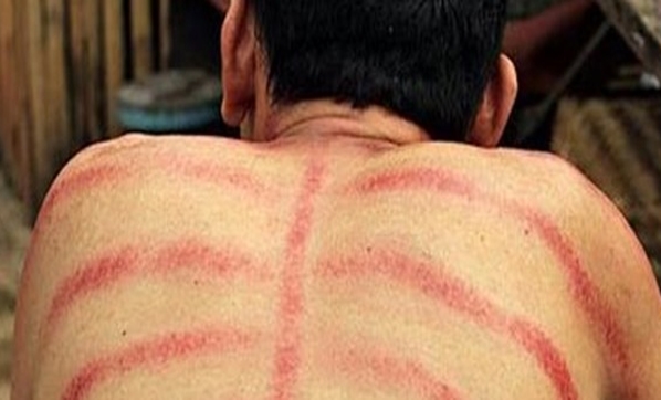 Para İle Hastalık Tedavi Ediliyor