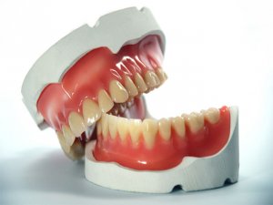 Diş Protezi Bakımı İhmali Ağız Hastalıklarına Sebep Oluyor