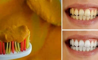 Dişleri Beyazlatan Doğal Yöntemler!