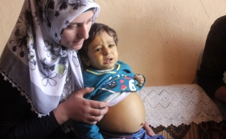 Şerzan Bebek Karaciğer Nakli Bekliyor