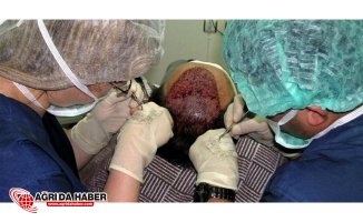 Bilim Adamların'dan Kelliğe Süper Çözüm