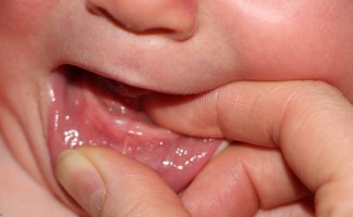 Bebeklerde Diş Çıkarma Belirtileri Nelerdir?