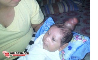 Filipinlerde Doğan Boynuzlu Bebek Görenleri Çok Şaşırttı!