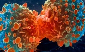 Bu belirtiler sizde varsa aman dikkat