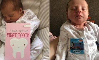 12 Günlük Bebek Ağzında Diş İle Doğdu