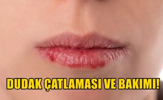 Dudak Çatlaması ve Doğal Tedavisi önerileri