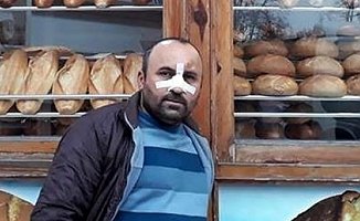 Ucuz Ekmek Sattığı İçin Dayak Yedi