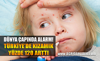 Dünya çapında kızamık Alarmı! Türkiye'de Kızamık Yüzde 120 Arttı
