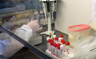 Türk Bilim Adamlarından Erken Tanı Kiti