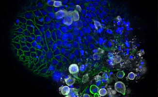 Koronavirüs'ün En Net Görüntüleri Ortaya Çıktı!
