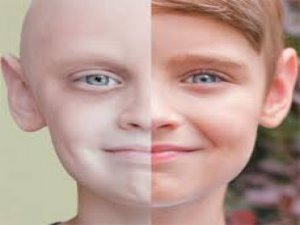 Kan Kanseri Tedavisinde Devrim Gibi İlaç Geliyor