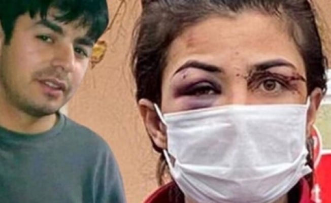 İşkence Gördüğü Kocasını Öldüren Melek İpek#39;in Cezası Belli oldu
