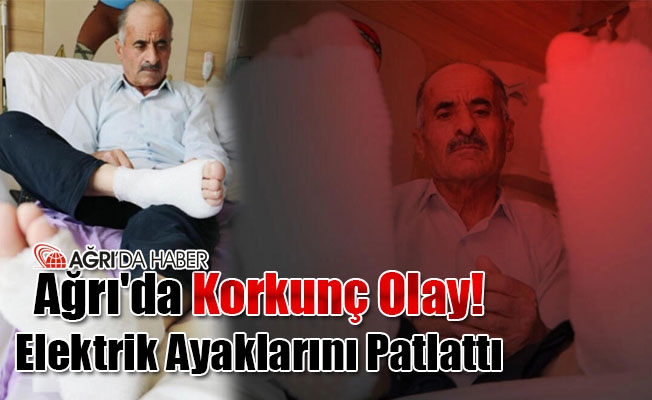 Ağrı#039;da korkunç olay! Elektrik Ayaklarını Patlattı