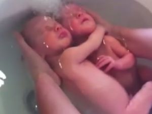 Yenidoğan ikizler doğduklarının farkında değiller